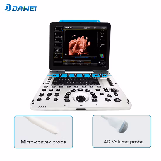 Chison Ebit50 4D 5D Portable Color Doppler Digital Dianostic Imaging System Human Ultrasound Gynecology, Cardiovascular Echo Machine